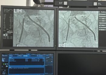 Табобати бемориҳои дилу рагҳо осон шуд